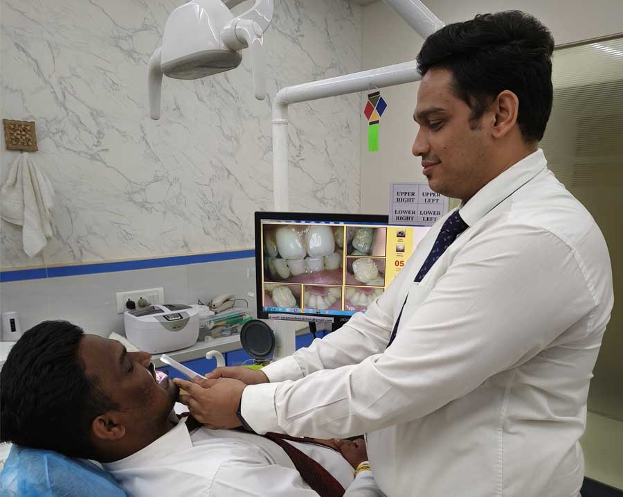Intra Oral Camera