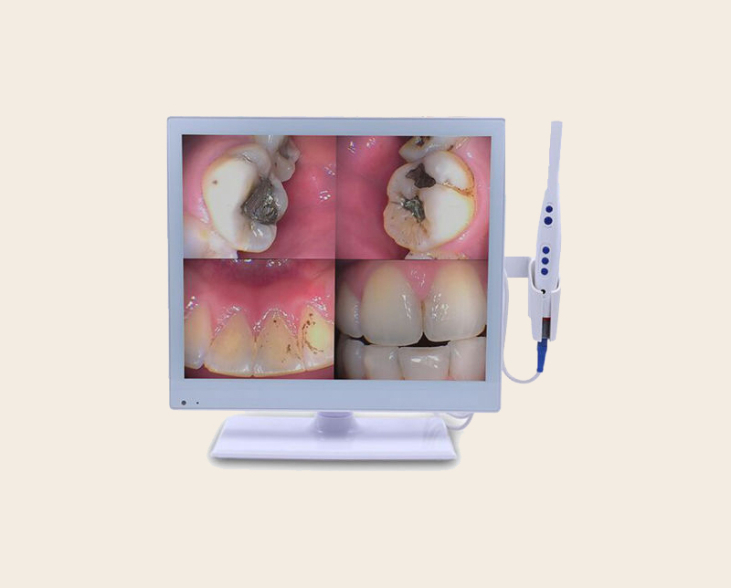 Intraoral Camera