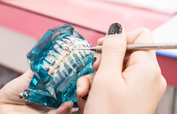 braces